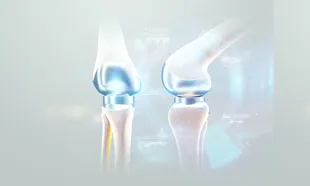 Orthopedic